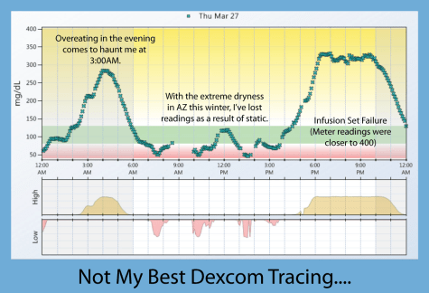 Dexcom Tracing