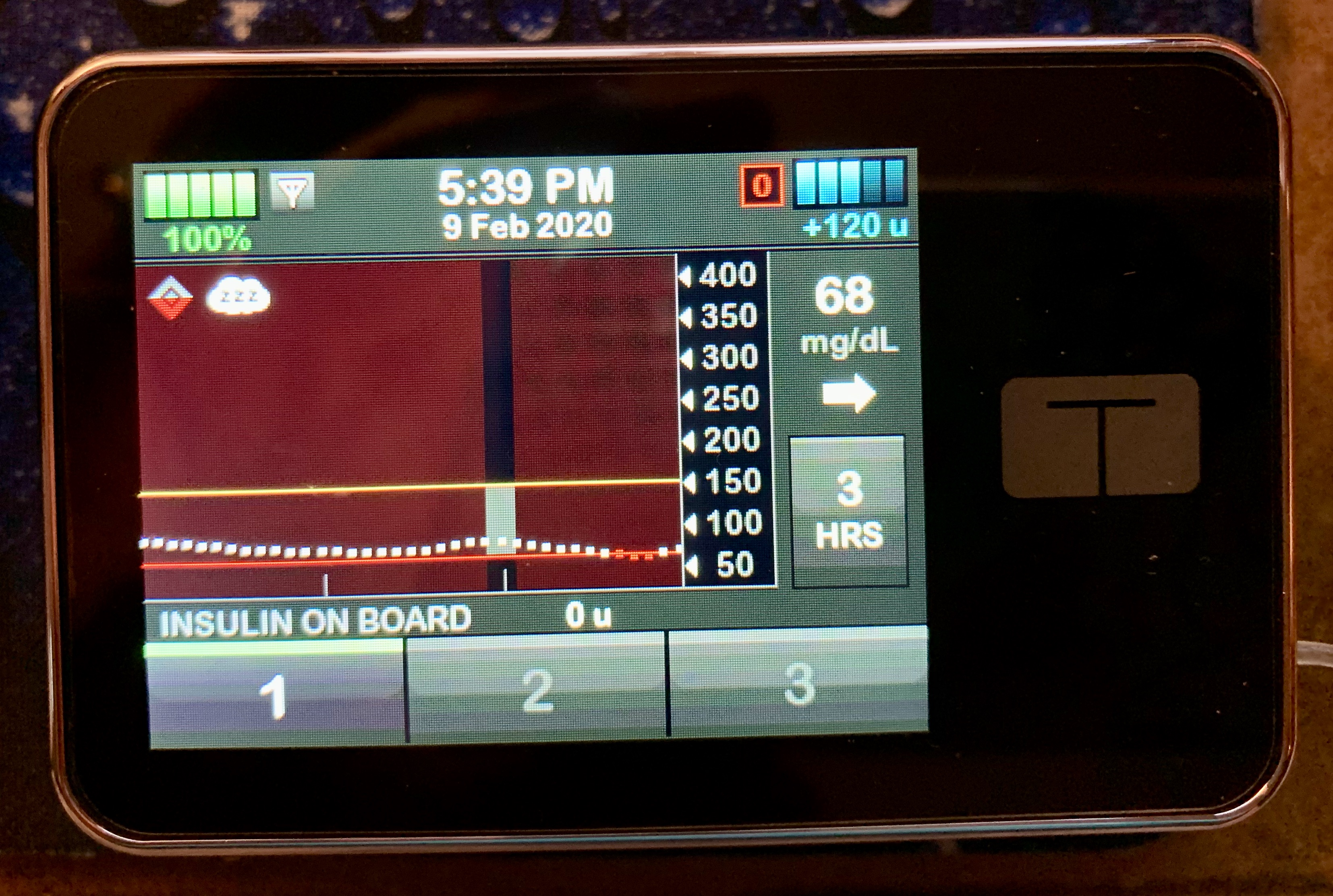 Initial Thoughts on Tandem Control IQ | Test Guess and Go